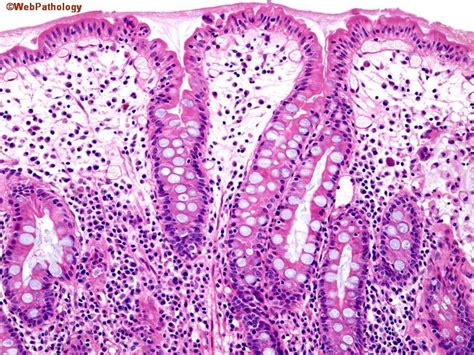WebPathology.